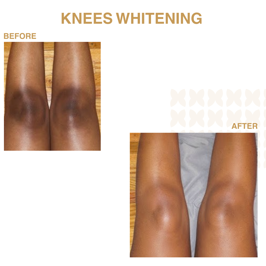KNEES