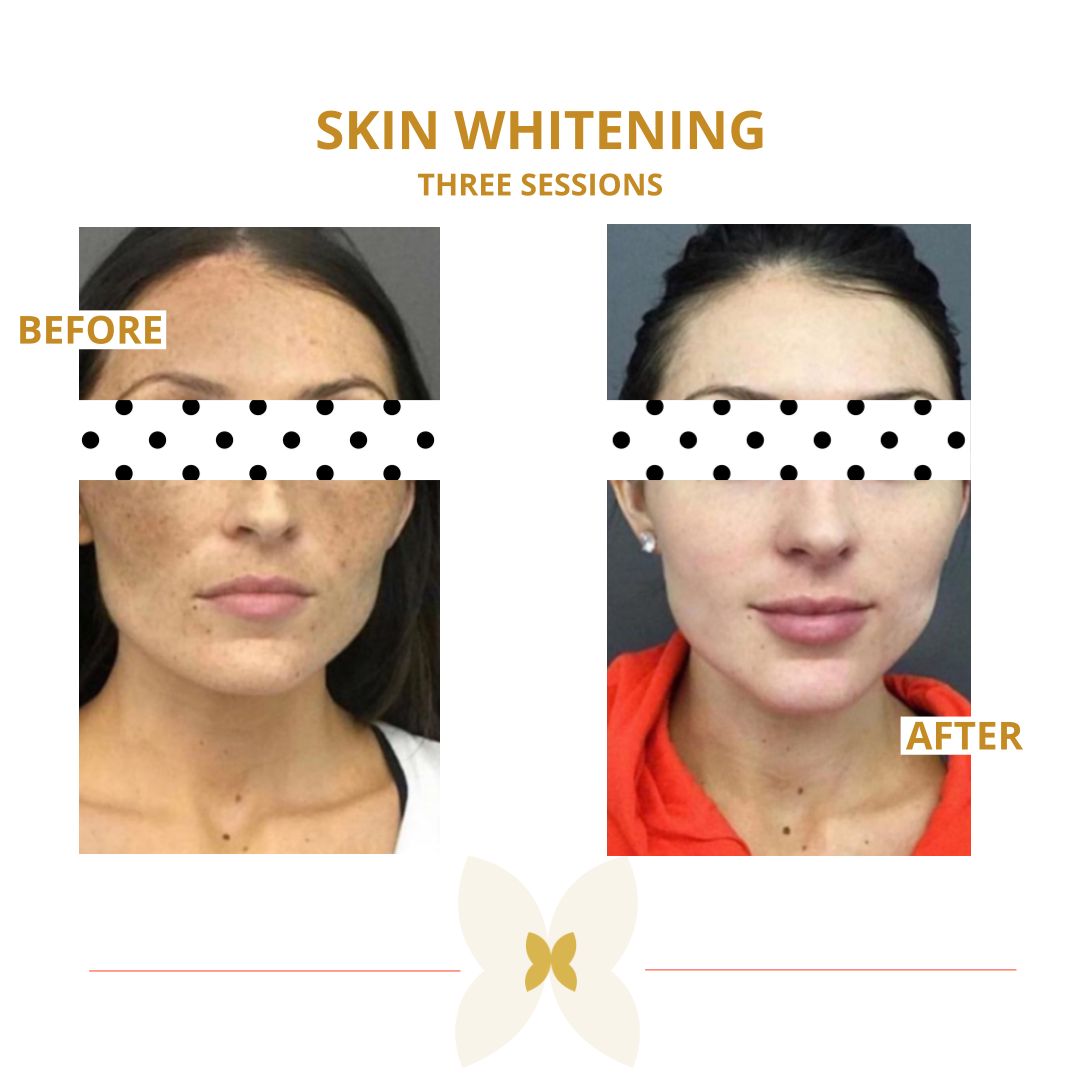 BUTT WHITE SESDERMA